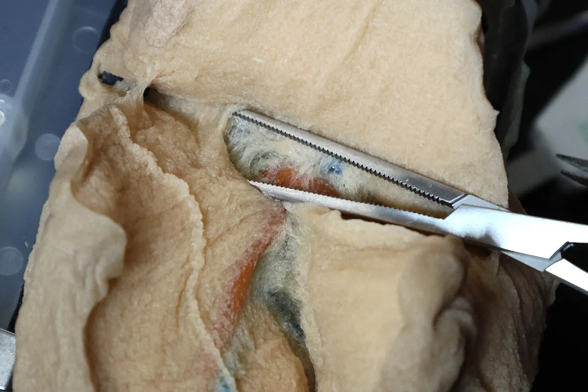 VTT Right Lobectomy Model【VTT-LUN00001】