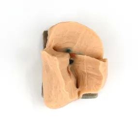VTT Right Lobectomy Model【VTT-LUN00001】